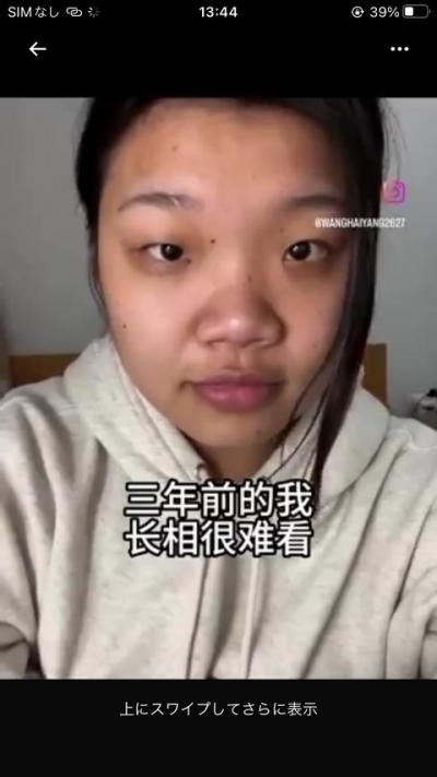 【画像】中国まんさん、韓国で大手術して超絶美女になる。想像の5倍美人