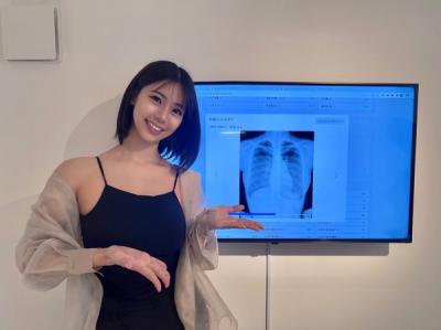 【画像】鈴木ふみ奈さん、偽乳疑惑に対しレントゲン写真を投稿「天然な事は証明できたのかな？」
